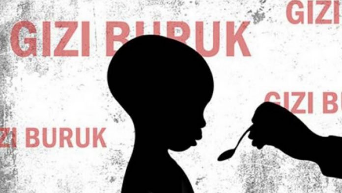 gizi buruk